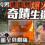有片|紐約男出門遭雷劈中奇蹟生還 憶恐怖經歷:雙腳腫脹全身劇痛