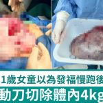 「假肥胖」警號|深圳女童慢跑後腹痛 體內竟藏4kg巨瘤驚險切除