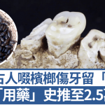 印尼古人啜槟榔伤牙留“圆沟” 人类“用药”史推至2.5万年前